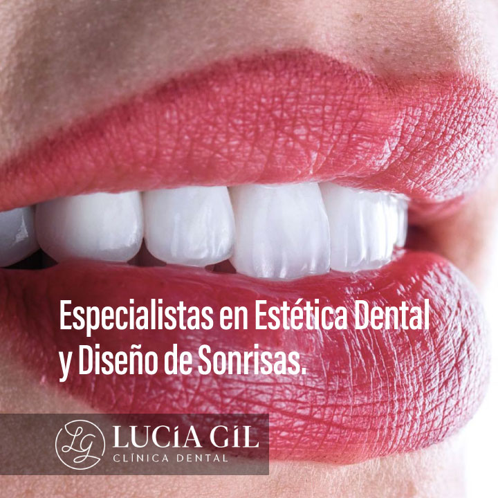 Clínica dental Valencia | Lucía Gil Raga | Dentista